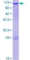 12.5% SDS-PAGE Stained with Coomassie Blue.